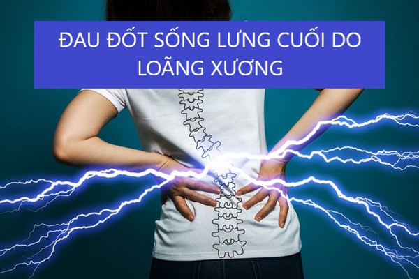 loang-xuong-lam-xep-dot-song-day-nhanh-thoai-hoa-dia-dem.jpg